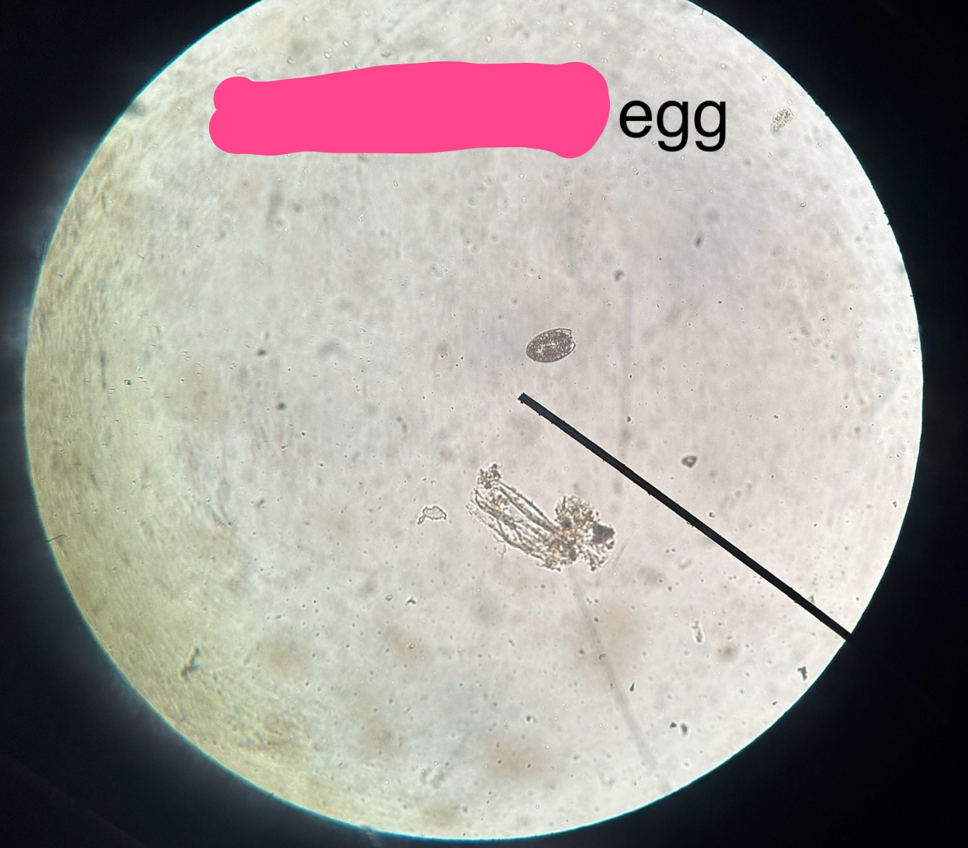 <p>ID egg</p>