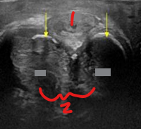 <p>Identify this image. </p>