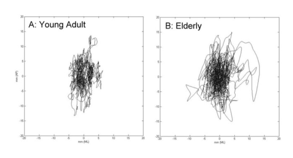 <p>there is an increase in postural sway</p>
