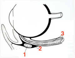 <p>what structure is 3?</p>
