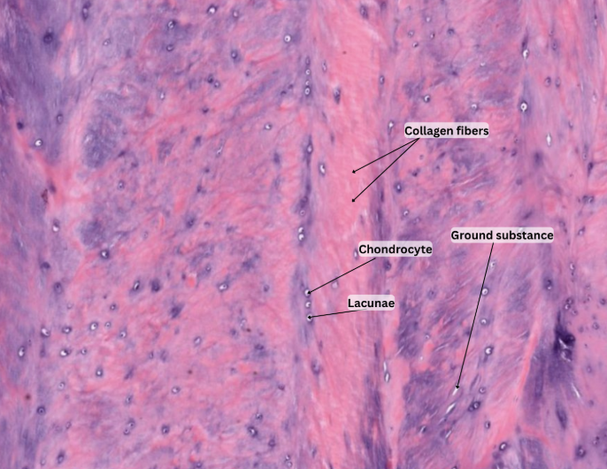 <p><span style="background-color: transparent;"><strong>FIBROCARTILAGE</strong></span></p>