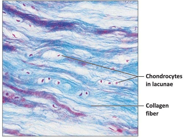 <ul><li><p>the middle man of properties of hyaline and elastic cartilages</p></li><li><p>only has collagen fibers</p></li><li><p>locations: intervertebral discs and knee</p></li></ul><p></p>