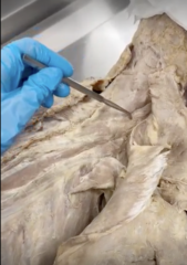 <p>Name the Muscle</p><p>- most superficial layer of posterior neck</p><p>- most lateral of the layer</p><p>- same layer has both splenius capitis and cervicis</p>