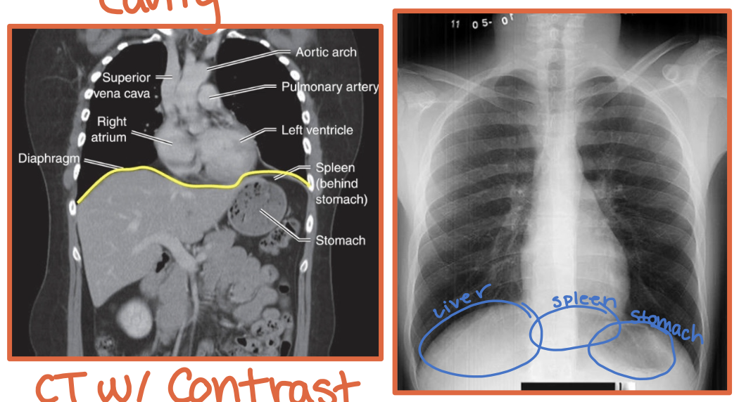 <p>A thin curved sheet of muscle separating the thoracic and abdominal cavities</p>