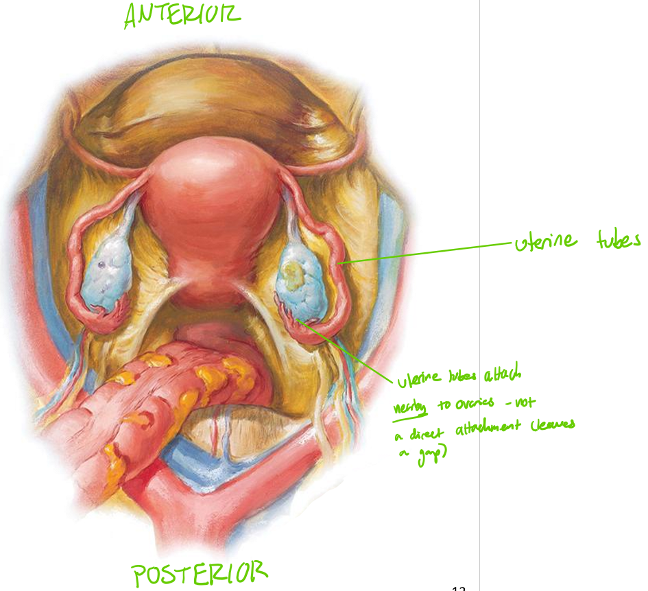 <ul><li><p>Uterine ligaments = <strong>paired muscular tubes</strong> extending from <em>uterus</em> → <em>ovary</em></p></li><li><p>AKA <strong>Fallopian tubes</strong> (though this term is not used anymore)</p></li><li><p>Located in <strong>superior</strong> aspect of <strong>broad ligament</strong></p></li><li><p>Open into <strong>peritoneal cavity</strong> near ovary</p><ul><li><p>Not actually connected to ovary; ‘waft’ the egg from the ovary into the tube</p></li></ul></li></ul><p></p>