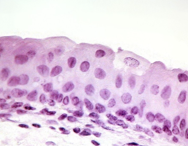 <p><strong>Se destiende y recubre la vejiga </strong>(urotelio/transicional)</p>