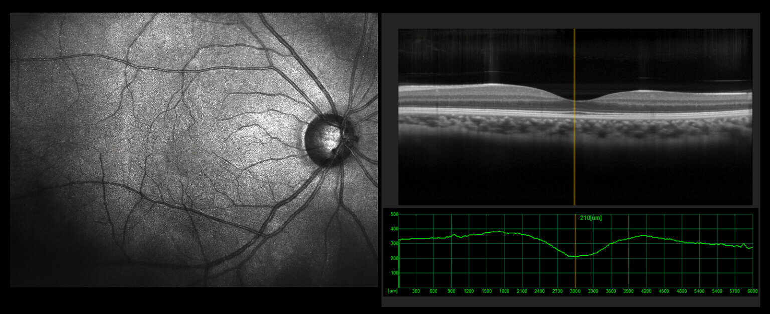 <p><span><span>generate an image which aids in the diagnosis and monitoring of eye conditions</span></span></p>