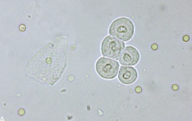 <p>Identify the clump of cells that are round to oval in shape with a distinct cell border and a centrally located nucleus.</p>