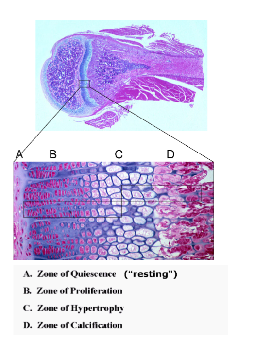 <p>Resting, proliferation, hypertrophy, calcification.</p>
