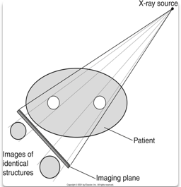 <ul><li><p>Decrease OID = decrease in distortion and magnification </p></li><li><p>Have central ray perpendicular to film</p></li><li><p>Have plane of object parallel to film</p></li></ul><p></p>