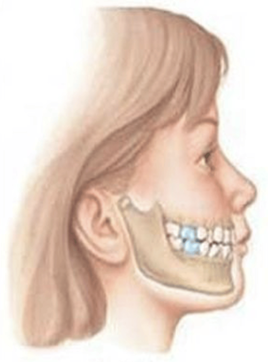 <p>ID the occlusal classification:</p>