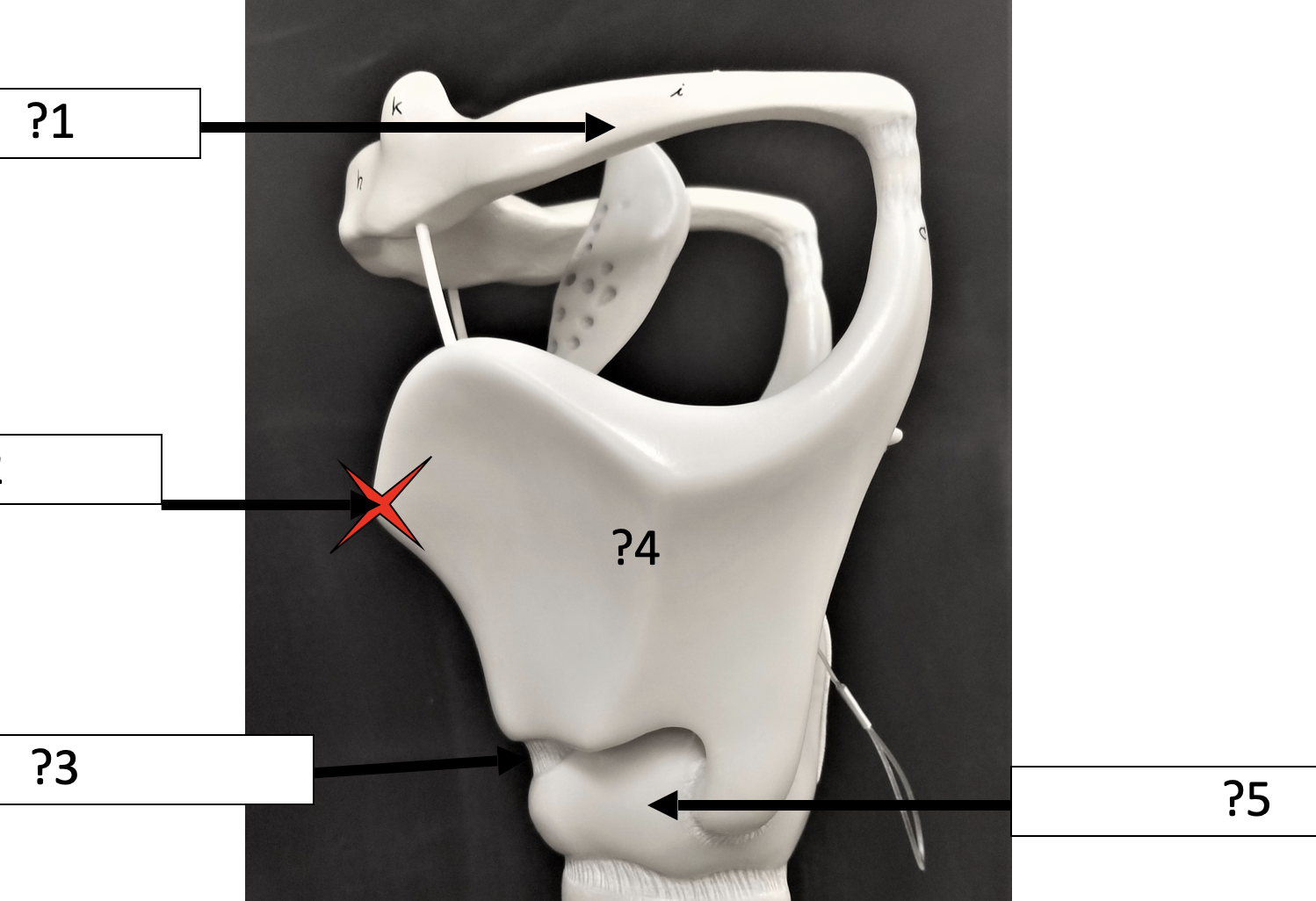 <p>5 Name the structure? </p>