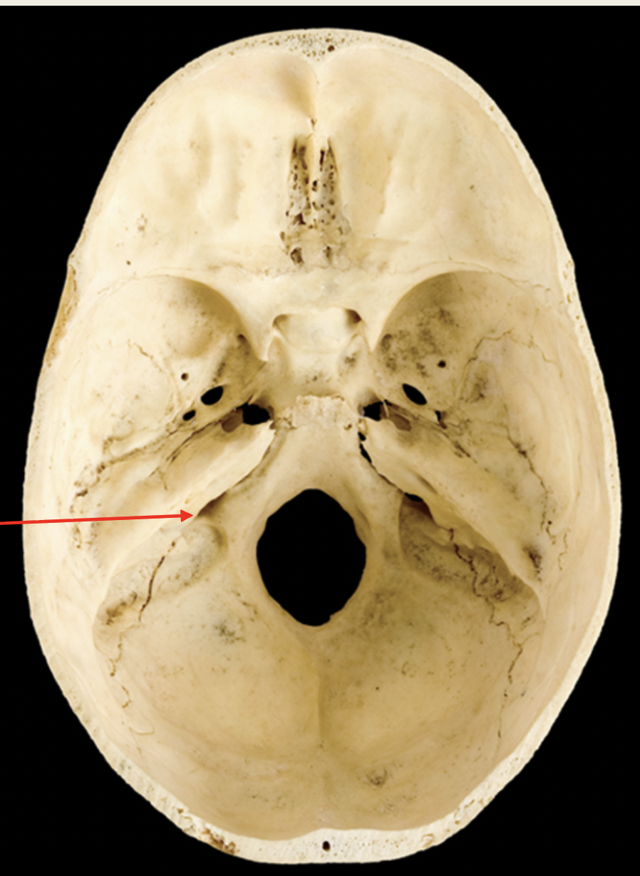 <p>Accessory</p><p>Nerve (XII)</p><p>■ Function: innervates</p><p>muscles of the XX</p><p>and XX, important for</p><p>XX (Motor)</p><p>■ Passes through XX XX</p>