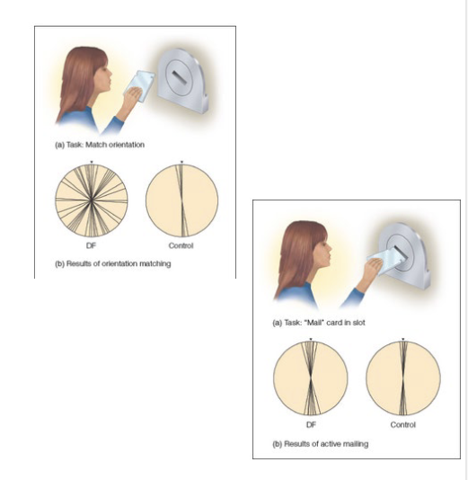 <p>• Patient D.F.</p><p>• Temporal lobe damage (carbon monoxide)</p><p>• Unable to perform mail slot task when matching orientations</p><p>• Able to do it when asked to “mail” a letter</p>