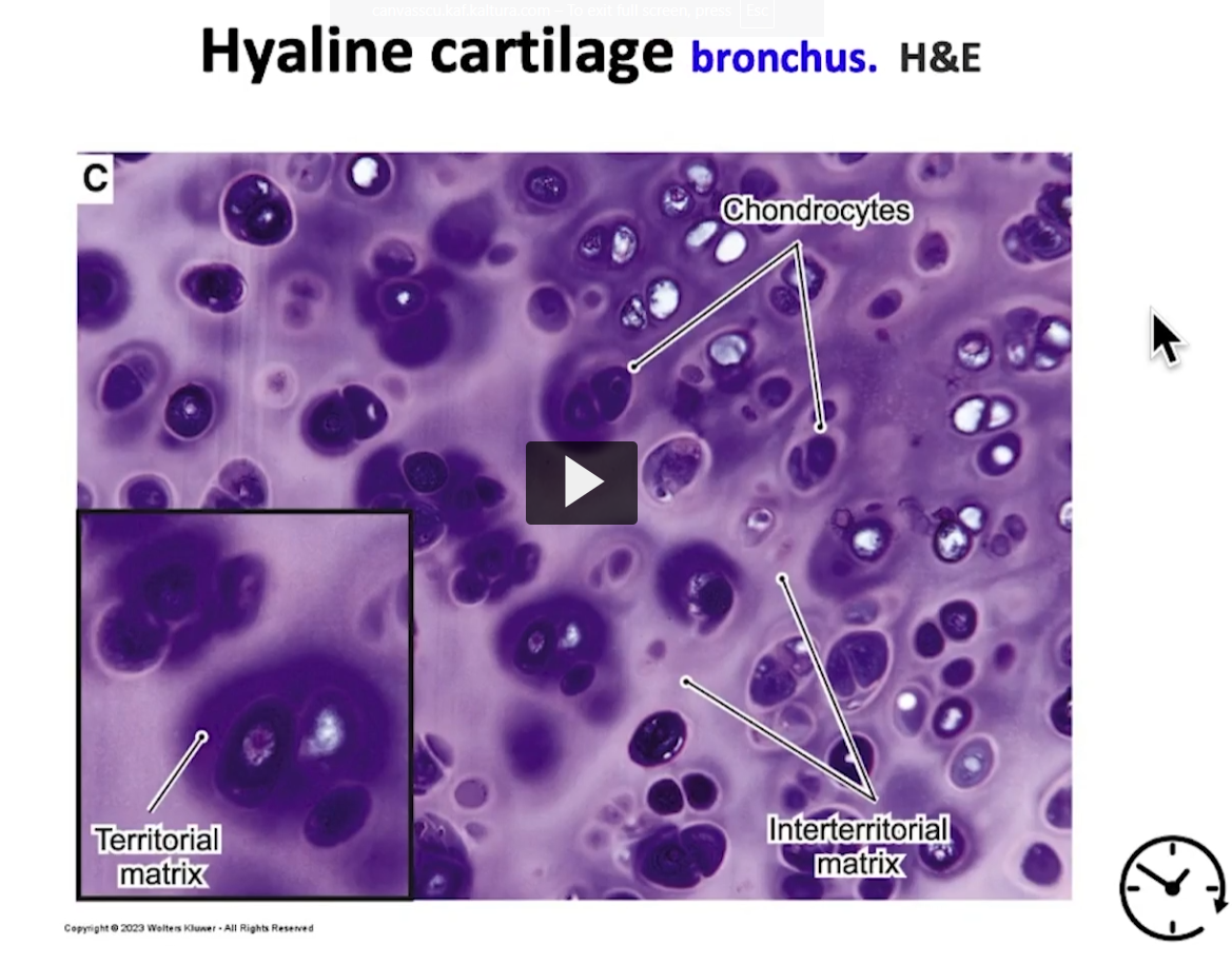 <p>Observe the chondrocytes in their lacunae, the interterritorial matrix, and the territorial matrix, as well as the isogenous groups. This is a very good image to use as a review. </p>