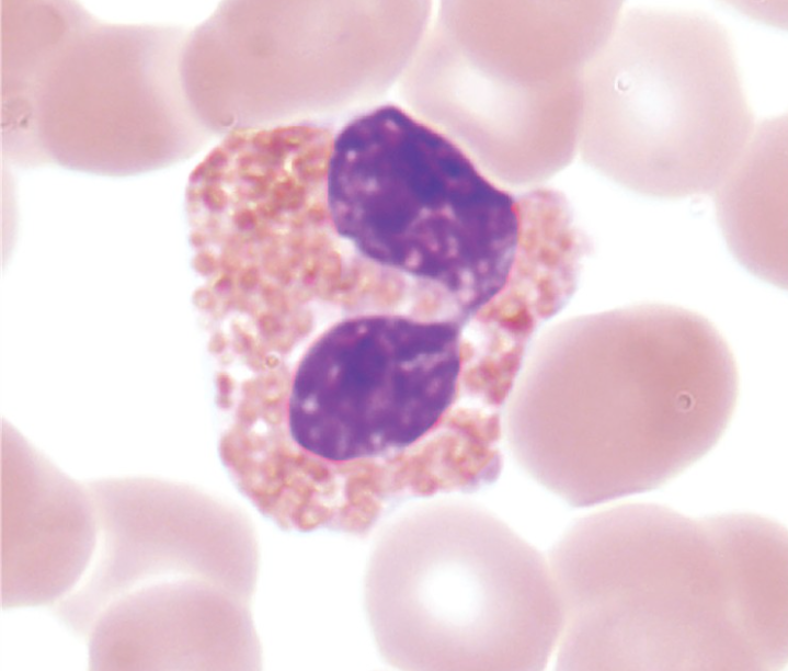 <p>Which WBC is this?</p>