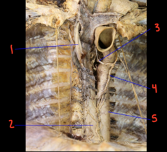 <p>What is labeled 1?</p>