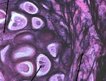 <p>elastic cartilage connective tissue</p>