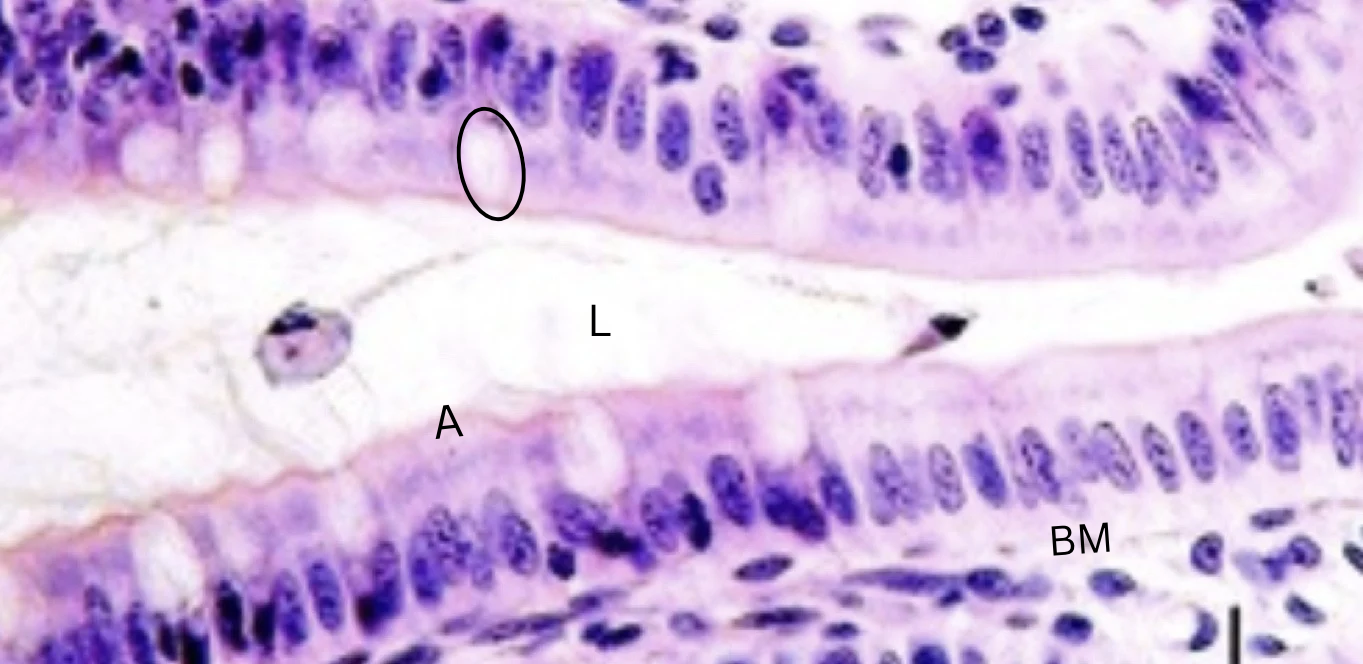 term image