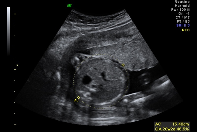 <p><span>What measurement is taken in this view?</span></p>