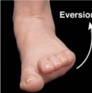 <p>Turning the foot outward</p>