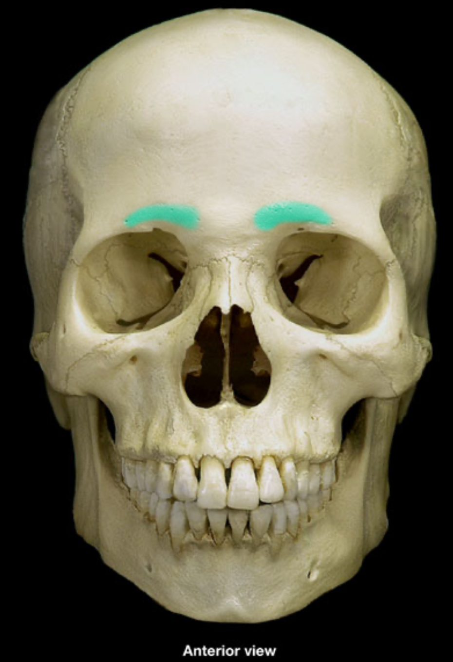 term image