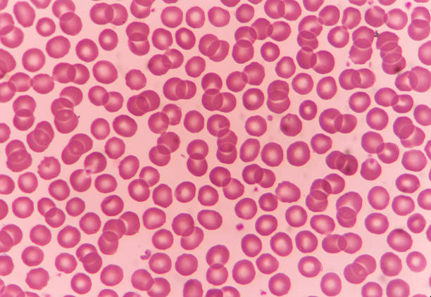 <p>Blood </p>