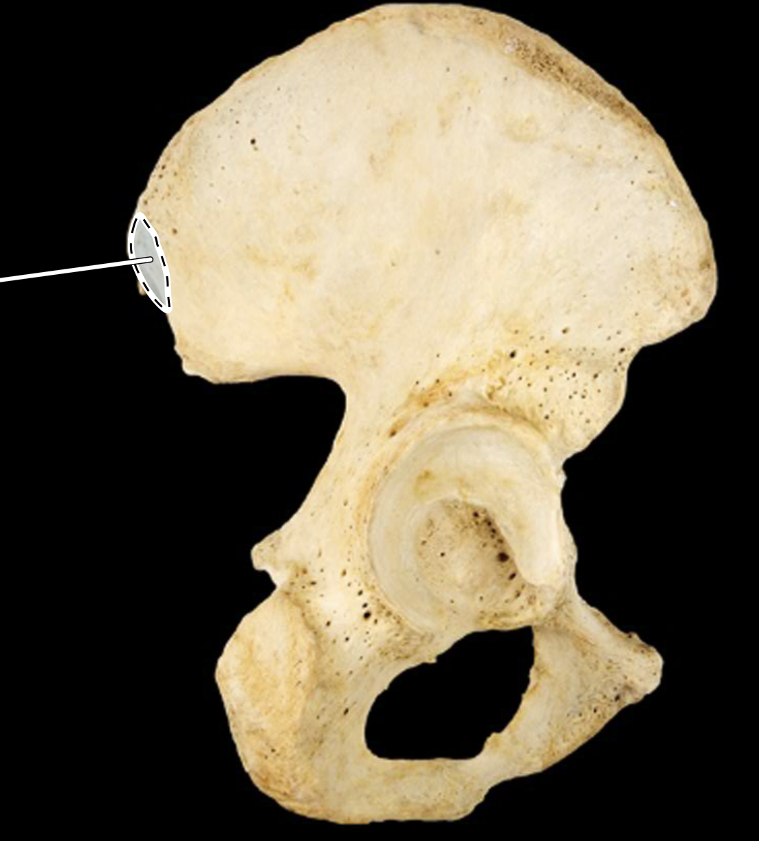 <p>lateral view, right side</p>