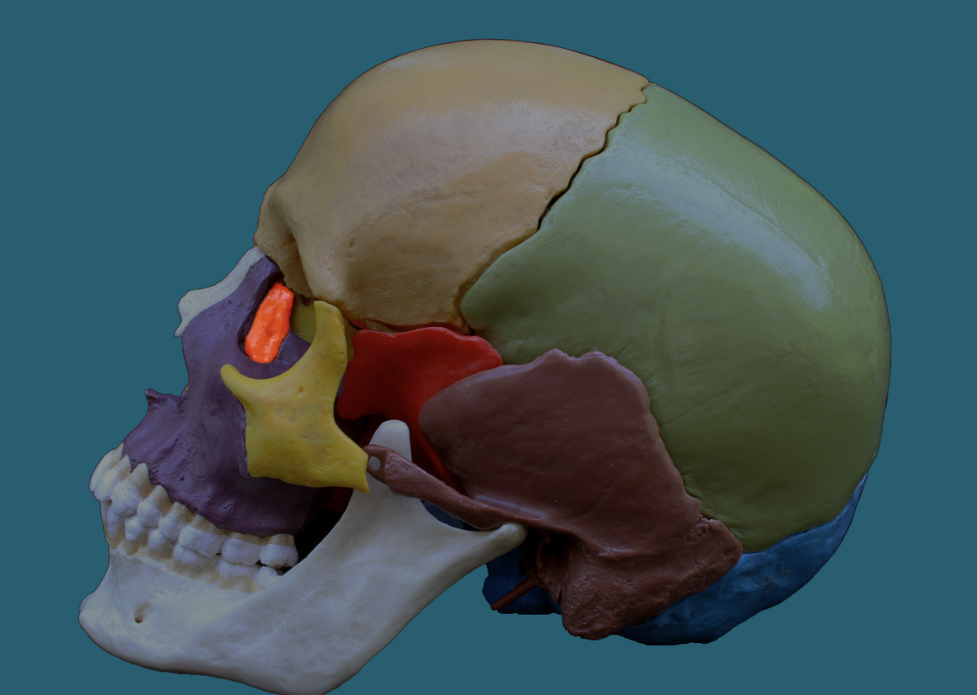 term image