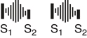 <p>Aortic Stenosis</p>