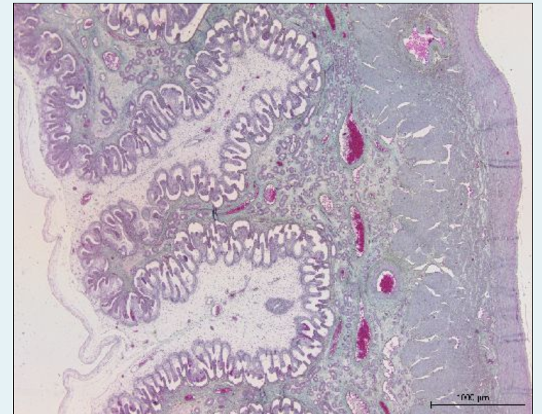 <p>where is the foetal and maternal</p>