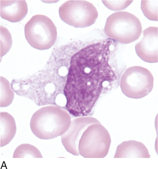 <p>what is a monocyte?</p>