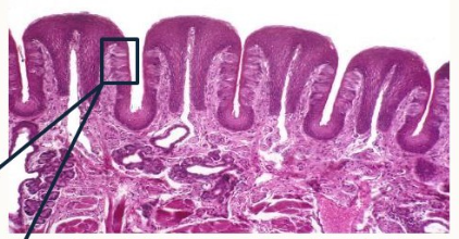 <p>What papillae are these?</p>