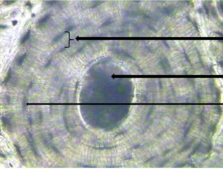 <p> <strong>a thin layer, membrane, or plate of tissue, especially in bone.</strong></p>