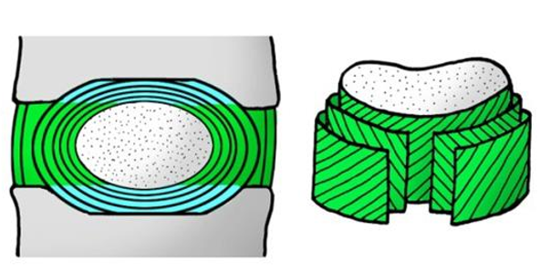 <ul><li><p>Concentric lamellae/angulations of collagen fibres</p></li><li><p>Permits movement in all directions</p></li><li><p>Resists excessive rotation</p></li></ul><p></p>