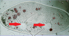 <p>a vacuole in some protozoans that expels excess liquid on contraction</p>