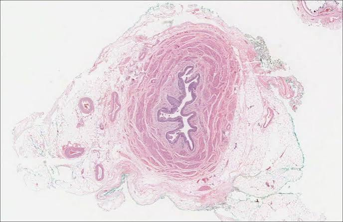 <p>ureter</p>