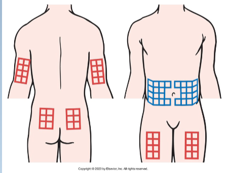 <ul><li><p>rotate sites</p></li><li><p>body part and within the body part</p></li><li><p>avoid hardened areas</p></li></ul><p></p>