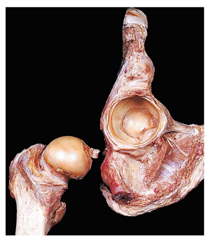 <p>Label the following:</p><ul><li><p>capsule</p></li><li><p>articular cartilage</p></li><li><p>tendons</p></li><li><p>femoral head and neck</p></li><li><p>labrum</p></li></ul><p></p>