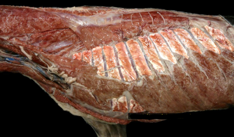 <p>• Superficial layer of the intercostal muscles </p><p>• Lie between the ribs </p><p>• Action</p><p> • Expands the rib cage → inspiration</p>