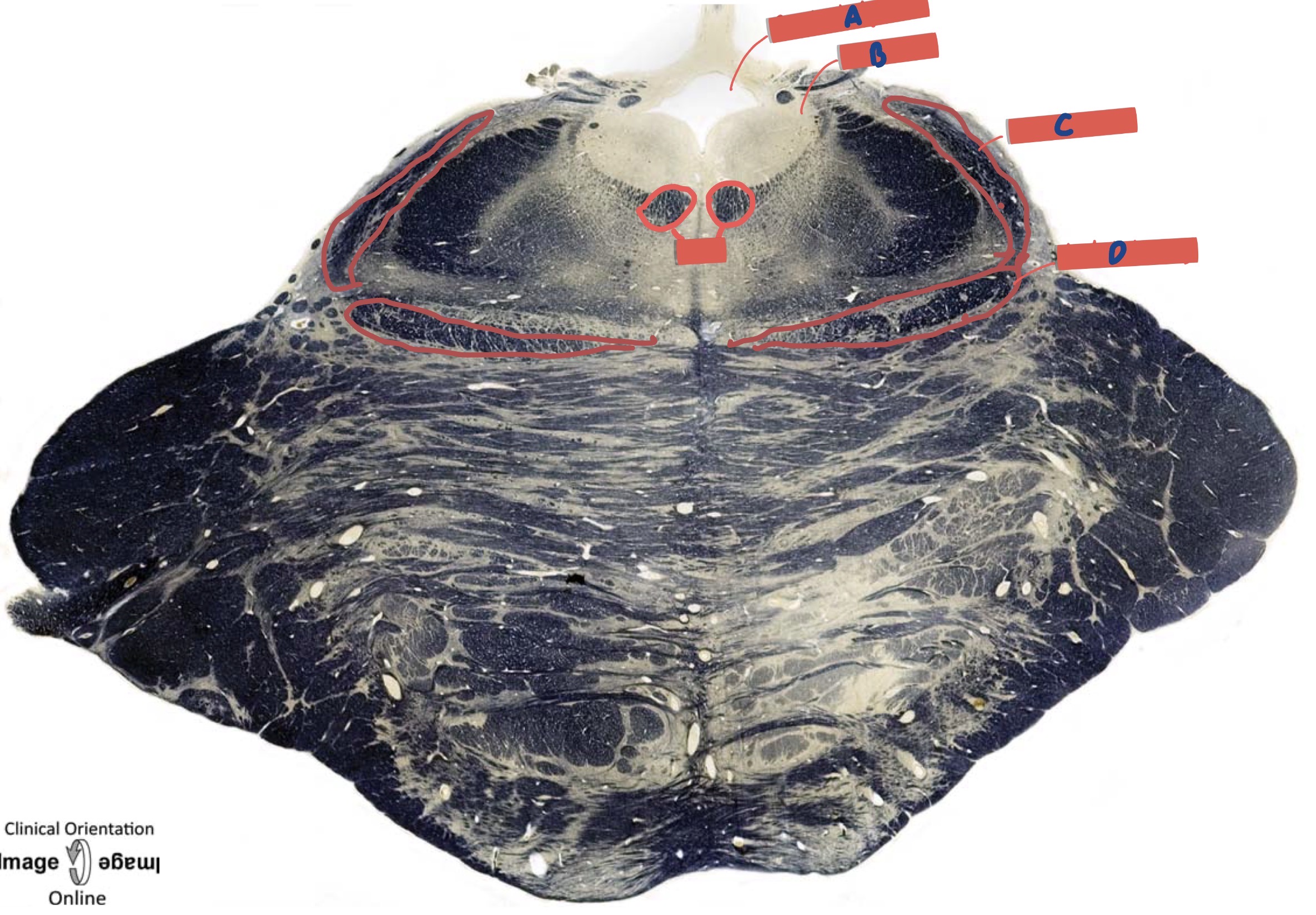 <p>What is below the periductal gray </p>