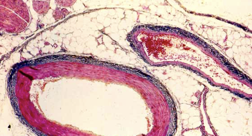 <p>long vein and round artery</p>