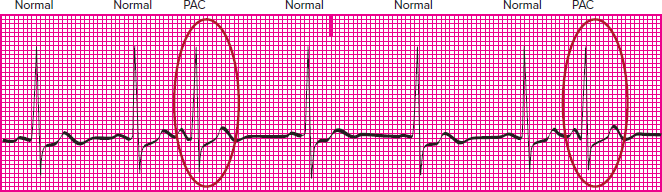 <p>Which rhythm is this?</p>