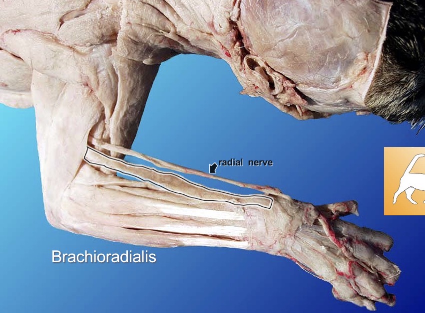 <p>Brachioradialis</p><p>action: flexes forarm</p><p>s: brachialis</p><p>a: triceps brachii (any triceps brachii)</p>