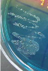 <p><strong>Blue-Green / Green</strong> Colonies (without black centers) on HE Agar:</p>