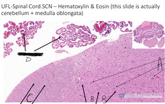 <p>What is indicated by the arrows labeled 'A' in this slide of cerebellum and medulla?</p>