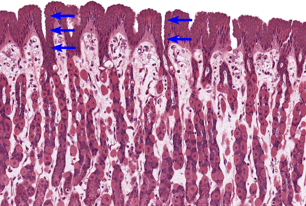 <p>Stomach</p><p><strong>NOTICE: THE DEEP GASTRIC PITS WITH DARK STAINED GASTRIC GLANDS AROUND THEM AND NOT MANY GOBLET CELLS</strong></p>
