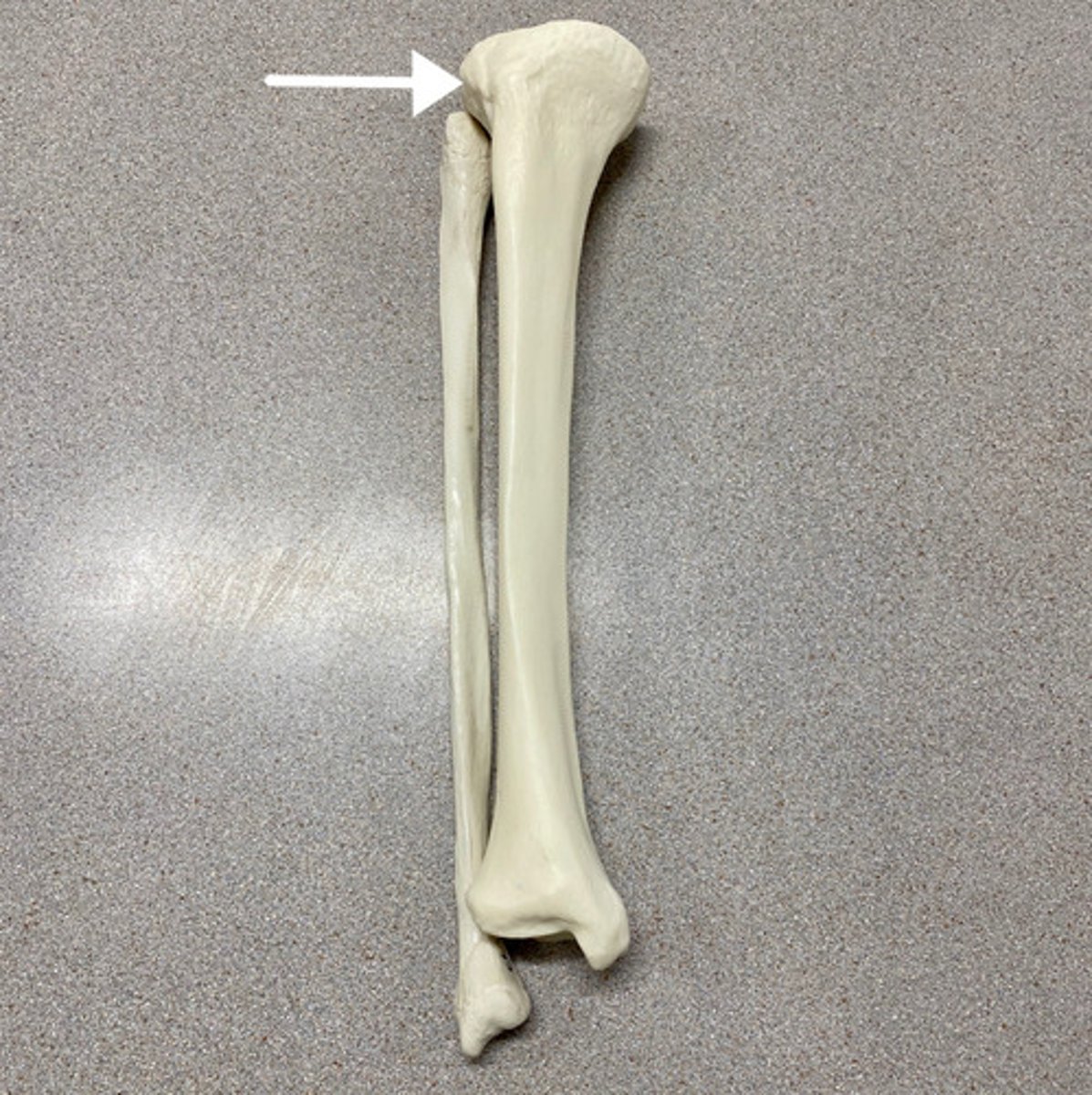 <p>What is this?</p>