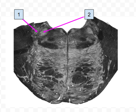 <p>1</p>
