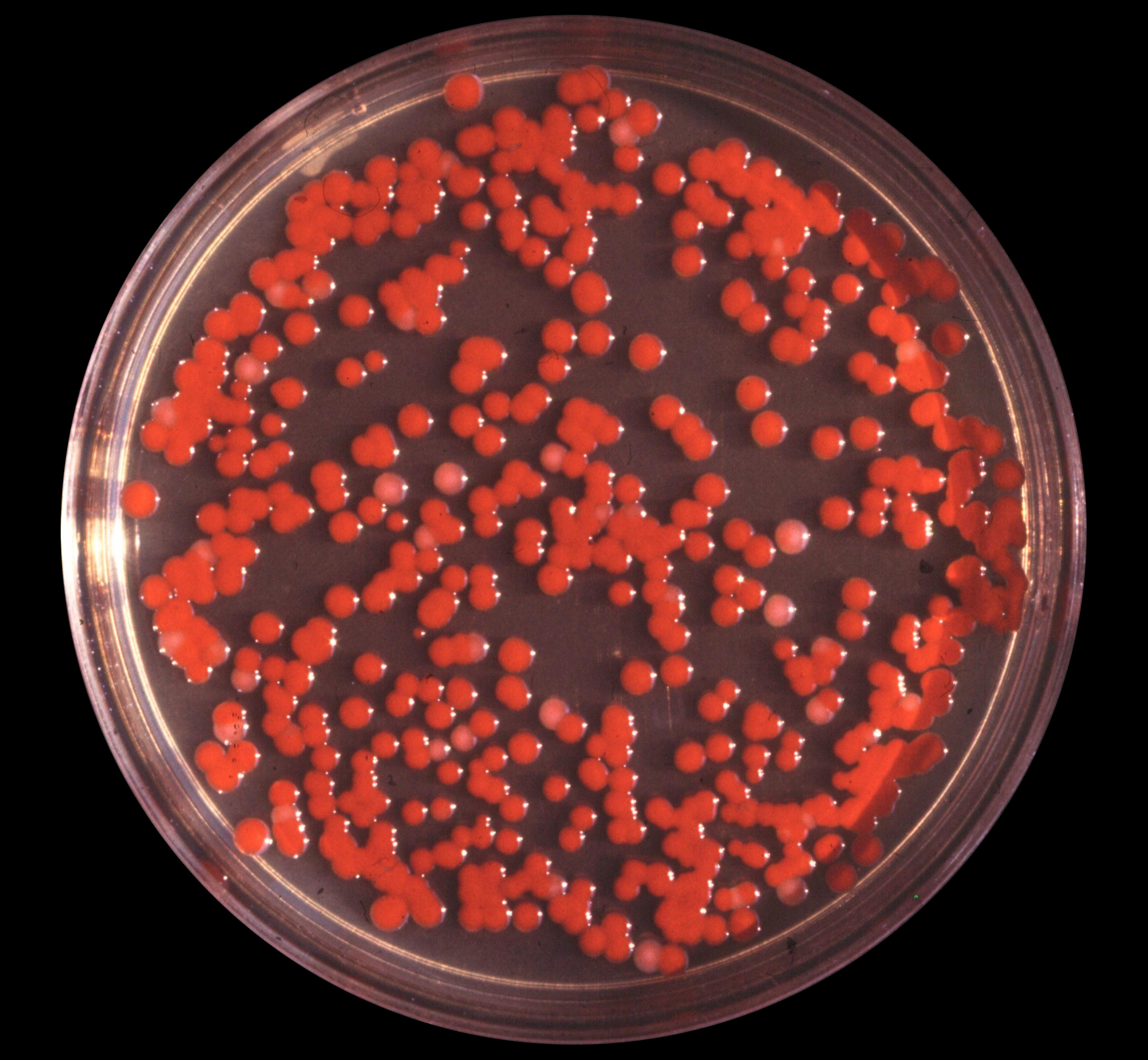 <ul><li><p><span><strong>Colony Morphology:</strong> On standard nutrient agar, colonies typically appear circular, convex, smooth, moist, and glistening.</span> [1, 2, 3, 4]</p></li><li><p><span><strong>Pigmentation:</strong> Depending on the strain and culture age, colonies vary from pale pink to a distinct dark, brick-red due to prodigiosin. <em>S. marcescens</em> grown in clinical settings is often non-pigmented (white or beige</span></p></li></ul><p></p>